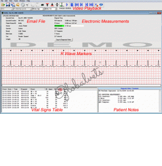 ECG File Reviewer